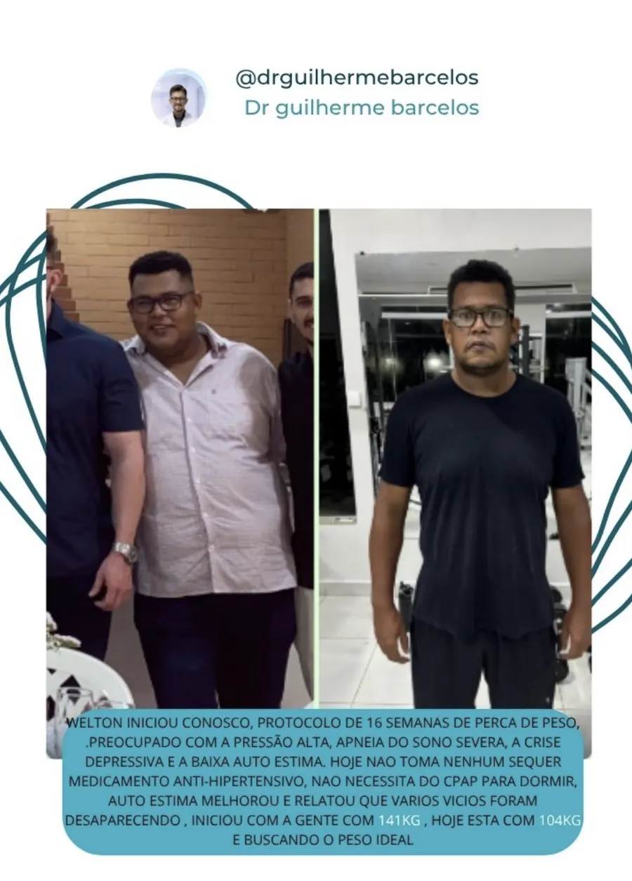 Registro de antes e depois de paciente acompanhado em protocolo de 16 semanas