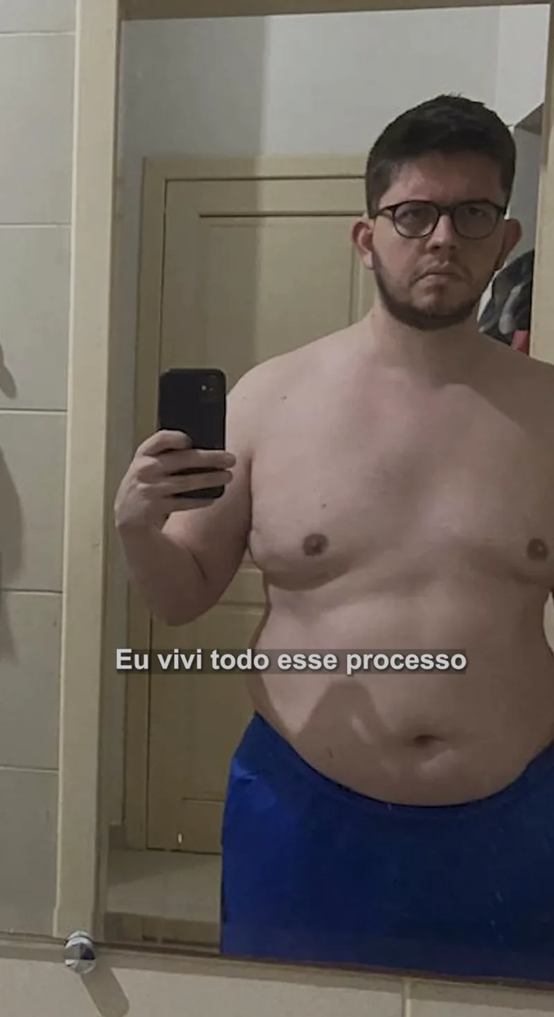 Dr. Guilherme Barcelos antes do próprio processo de emagrecimento